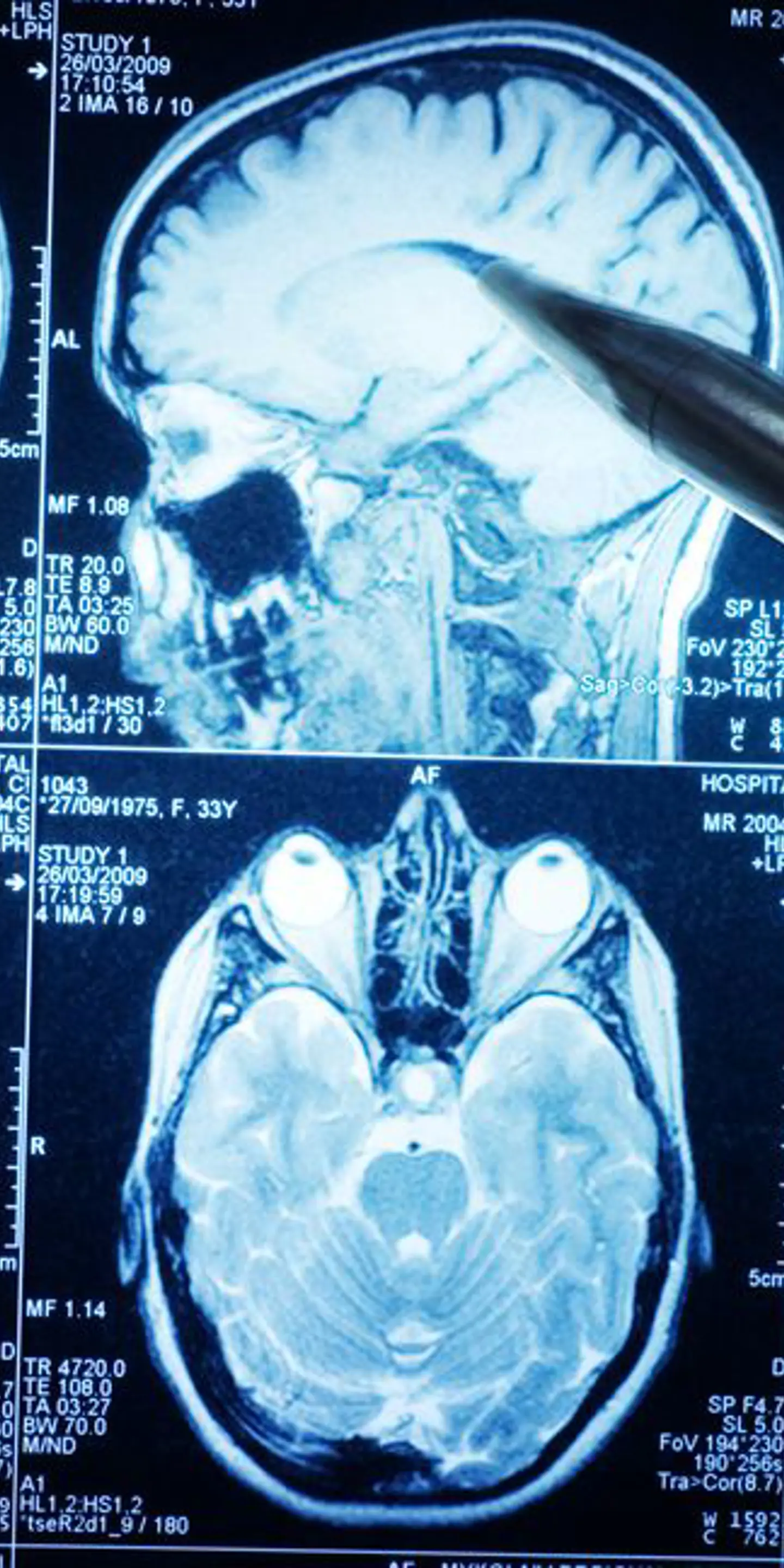 Neuroreader MRI