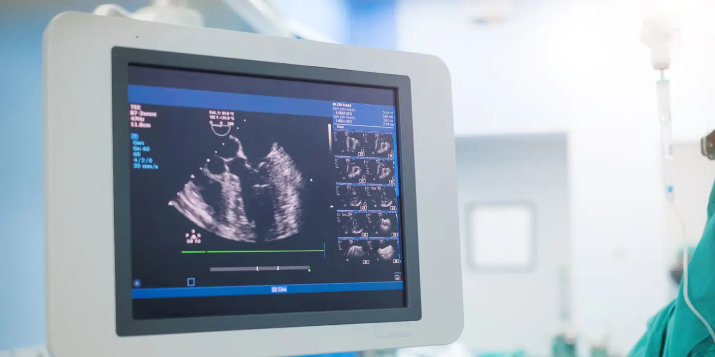 Echo Heart Scan Ultrasound (1)